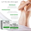 Effective Brightening Body Cream Armpit Legs Knee Elbow Bleaching Cream For Dry Skin Knuckles Lighten Dull Hand Skincare 4 size 5