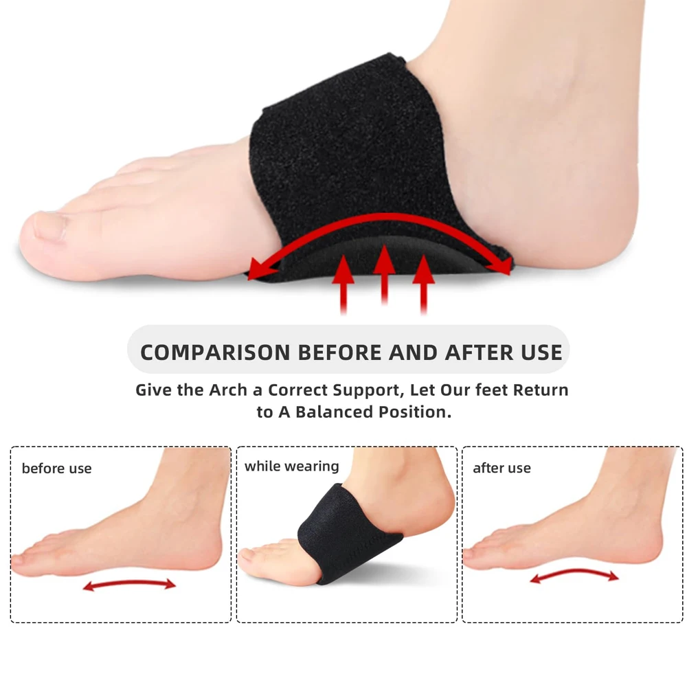 Pes Planus Low Instep Foot Pes Planus Flat Foot Supporter