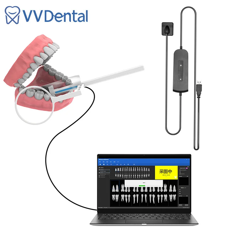 DentalRvgXraySensorDentalDigitalXRaySensorsforWoodpecker
