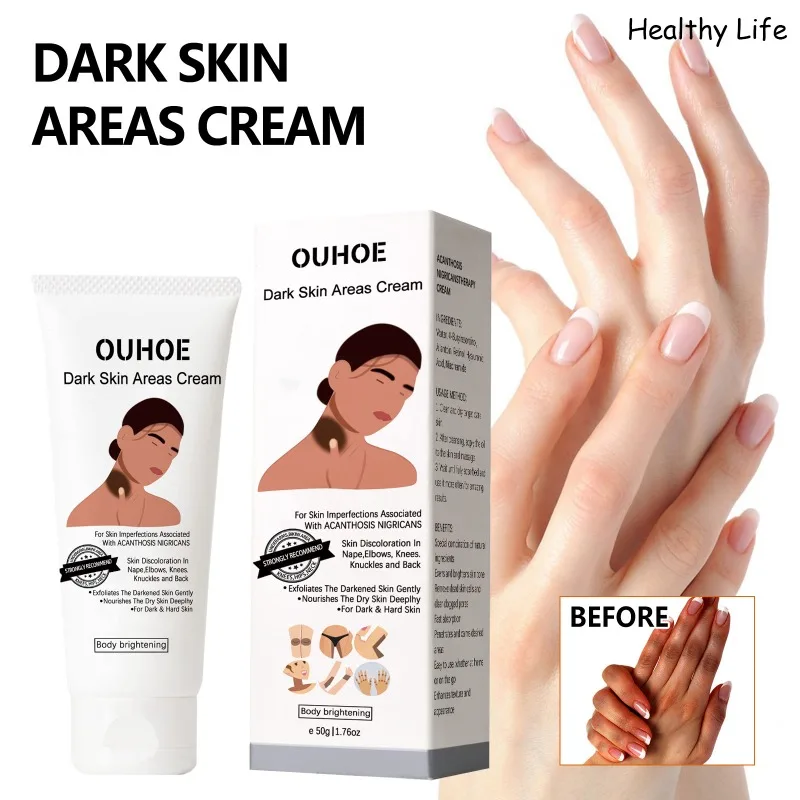 

Beauty Body Brightening Moisturize Cream Quick Brighten Private Parts Hand Knuckles Lotion Women Lighten Melanin Skin Care Cream