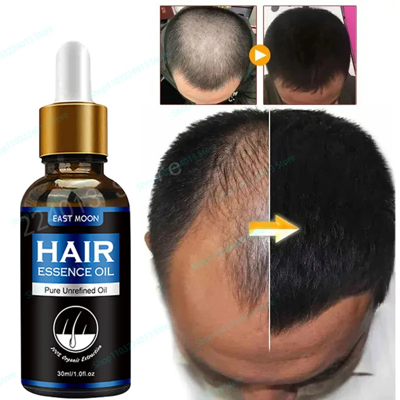 Strong Effect Hair Growth Products Ginger Essential Oil 2 Week Treat Hair Loss Scalp Repair Nourish Hair Roots Regrowth