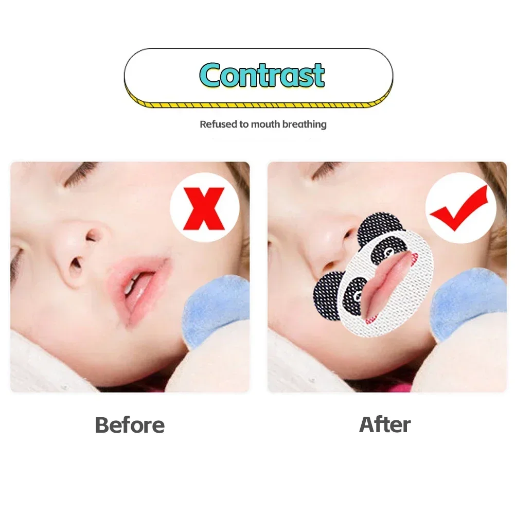 Anti-Snoring Cartoon Stickers 30/60Pcs for Children Sleep Closed-mouth Breathing Correction Lip Patch Cute Shut Up Orthosis Tape