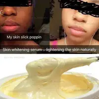 Strong lightening oil cream, Glowing cream, Moisturizing cream , 2 shades lighter 1