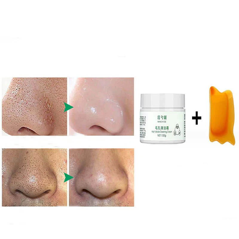 

100g Pore Cleansing Cream for Blackheads Pimples Facial Massage Cream Whitening Moisturizing Anti-wrinkle Anti-aging Skin Care