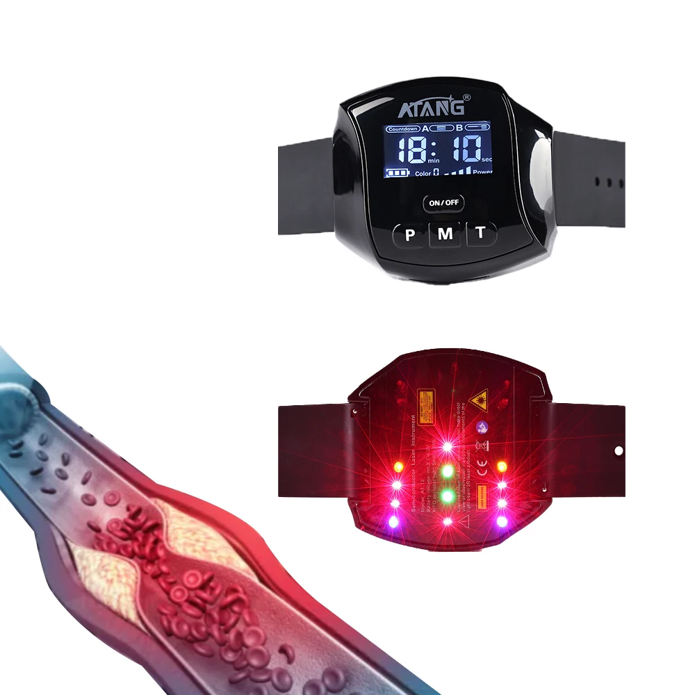 

Lasers Therapeutic laser Watch to help Heart Disease,Lasers Clean Cardiovascular Plaque,Cardiac Rehabilitation Device