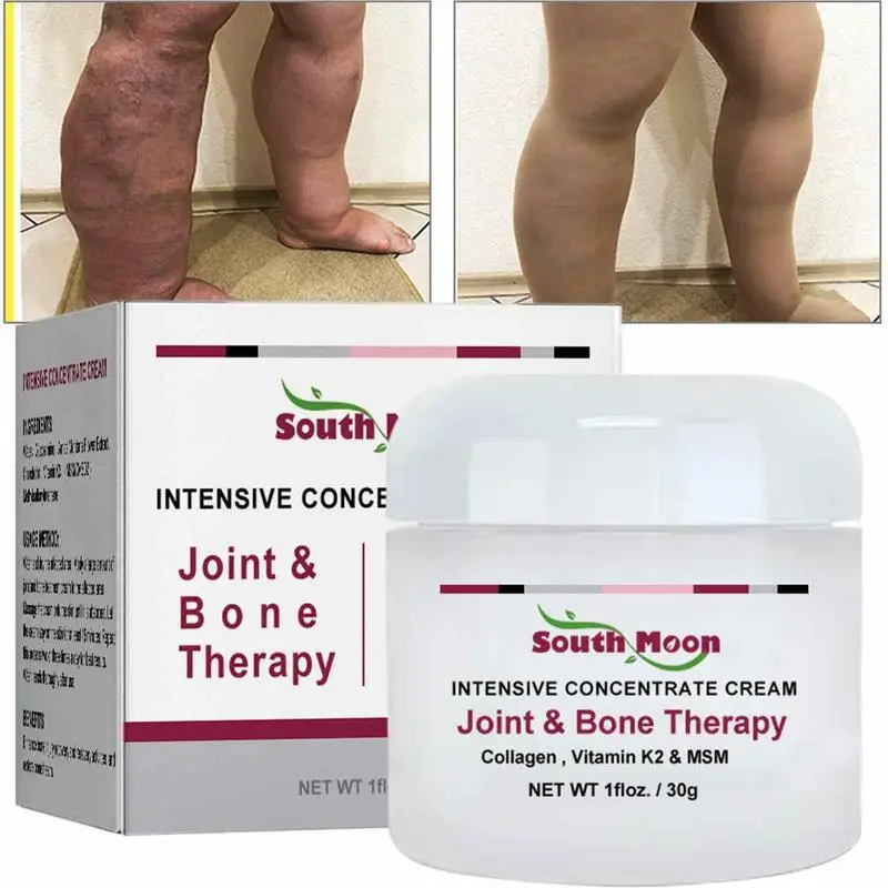 Rheumatoid Arthrosis Cream Treat Arthrosis Rheumatism Ointment Muscle