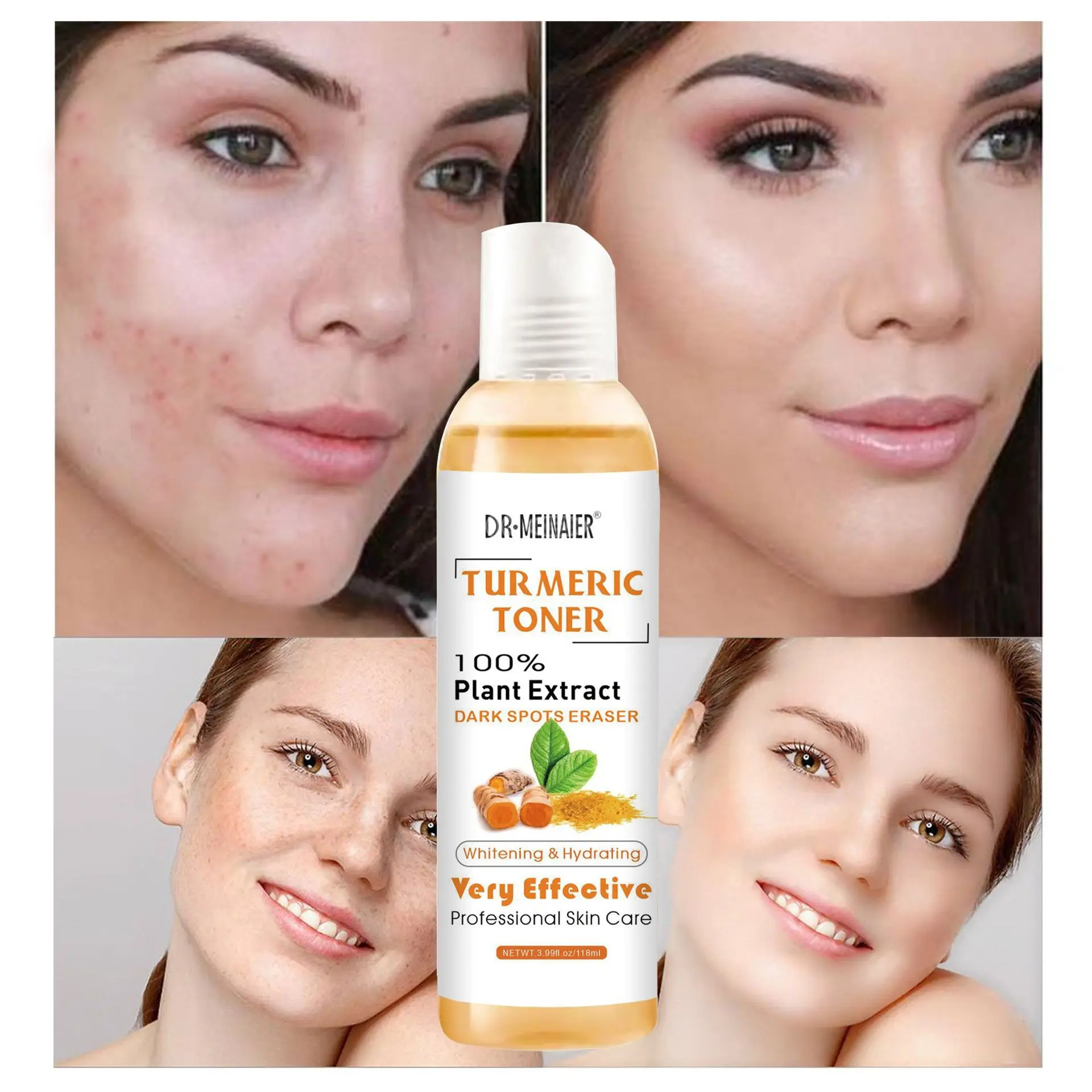 118ml Turmeric Moisturizing Toner Acne Remover Reduce Dullness & Black Spots Firming Skin Toner Essence for Skin Whitening