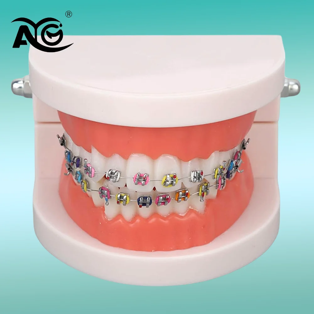 AG Dental Orthodontic Teeth Model with Colorful Braces, Professional Denture Mouth Model Demonstration Study Tool for Dentistry