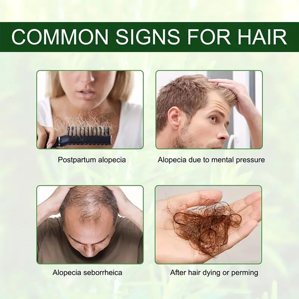 Hair Growth Essential Oil Rosemary Mint Hair Strengthening Oil Nourishing Treatment for Split Ends Dry Organics Care