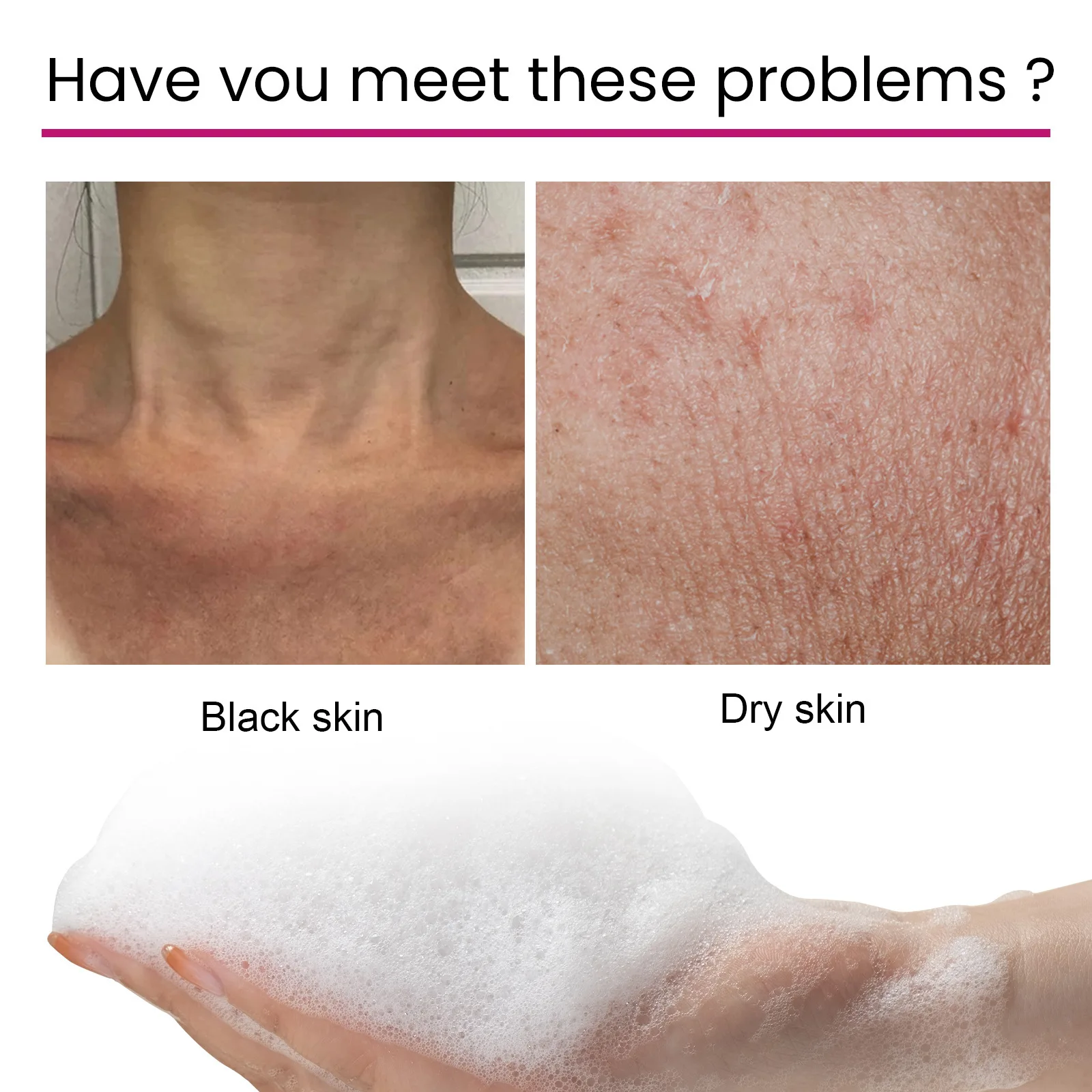 Рисунок 3 - Отбеливающее мыло корректор темных