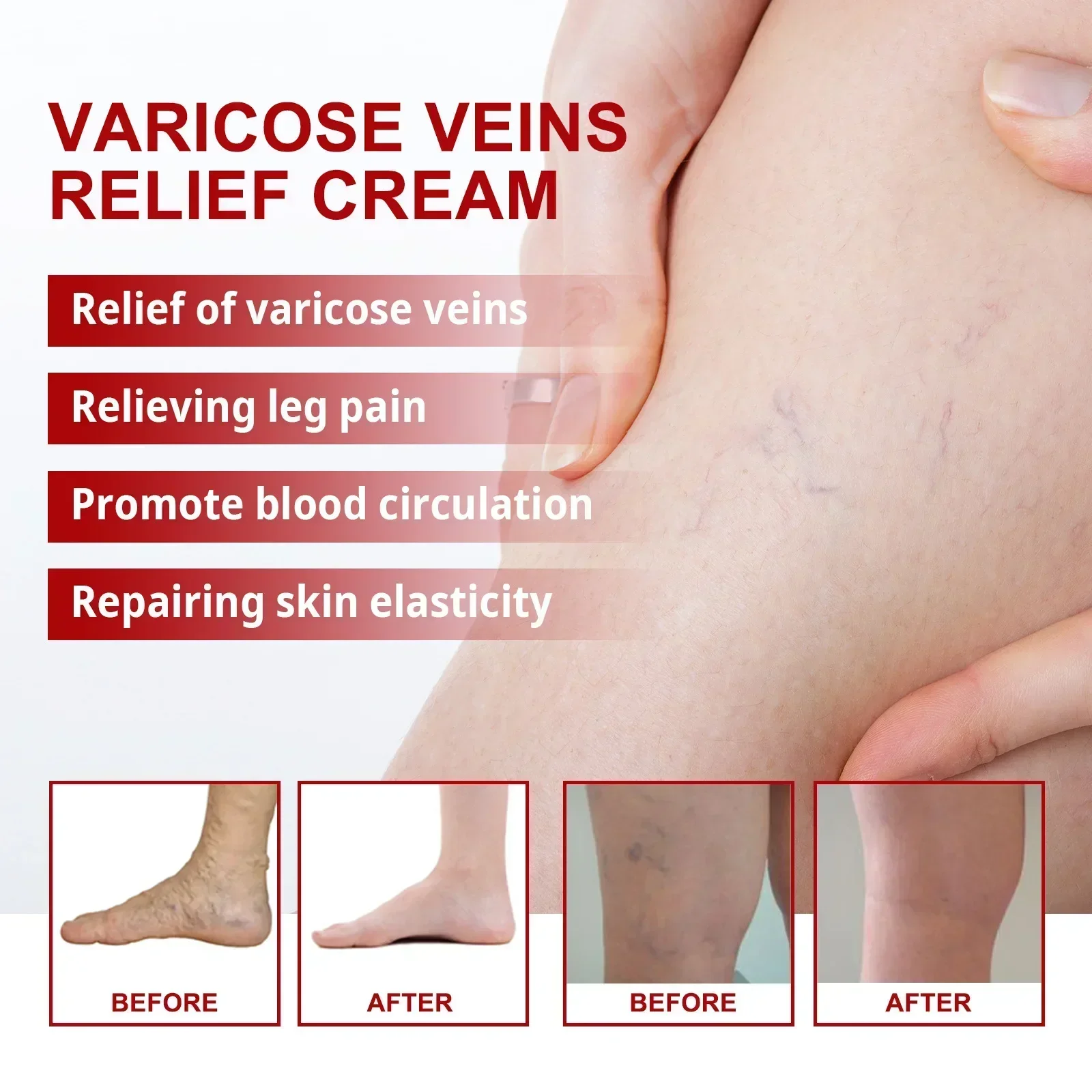 Leg Skin Care Cream