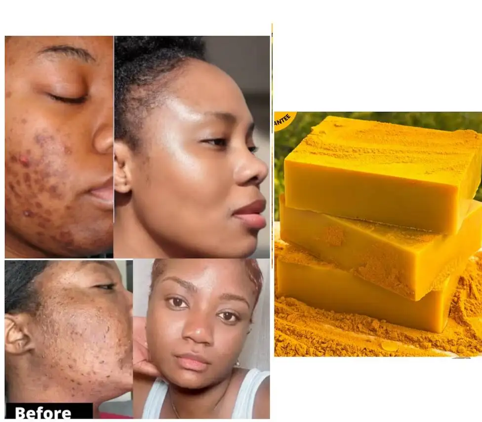 TurmericLemonKojicsoapGlowingskinbestsoapEver.jpg