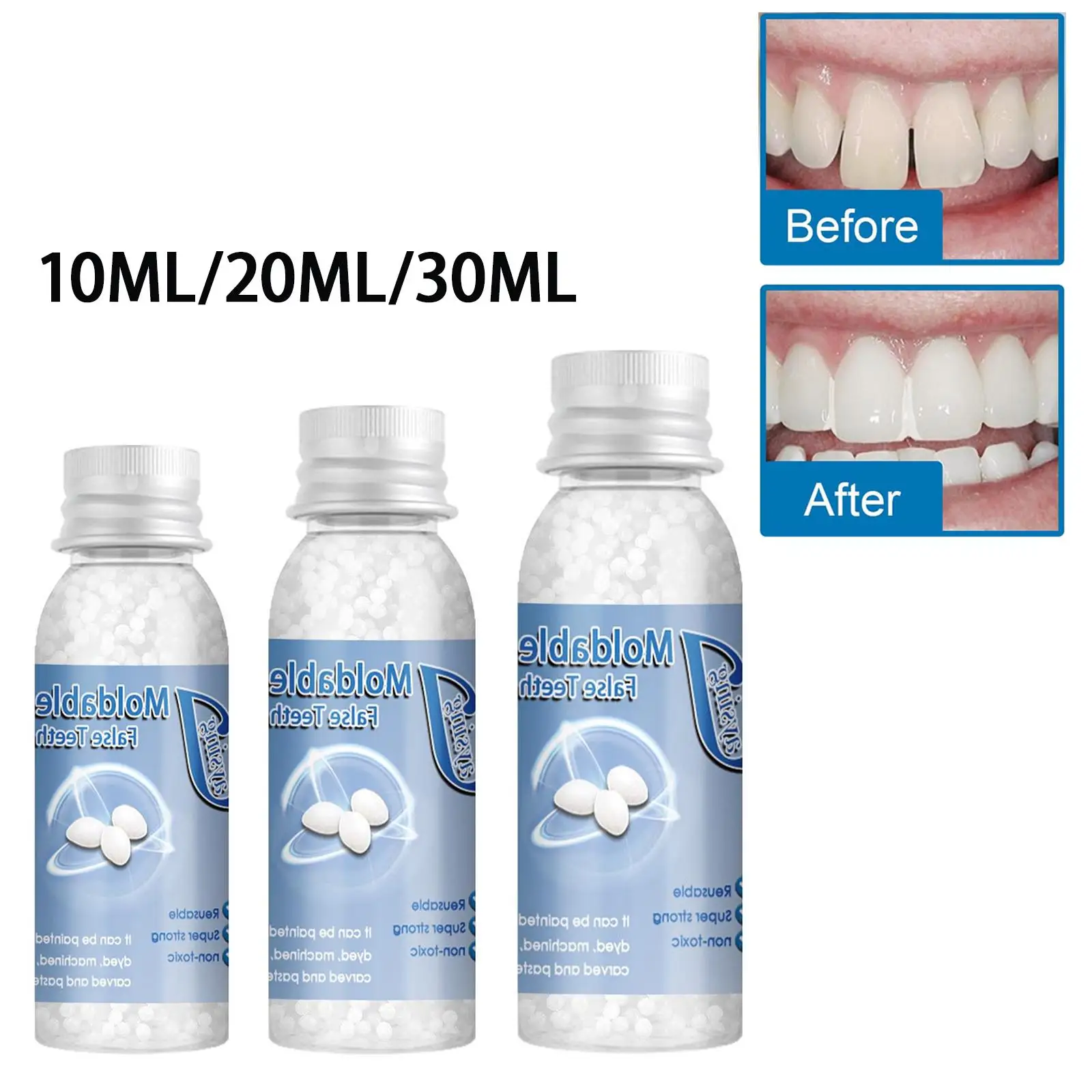 Thermal Beads Repair Granules Teeth Veneers Moldable for Big Gaps -  AliExpress