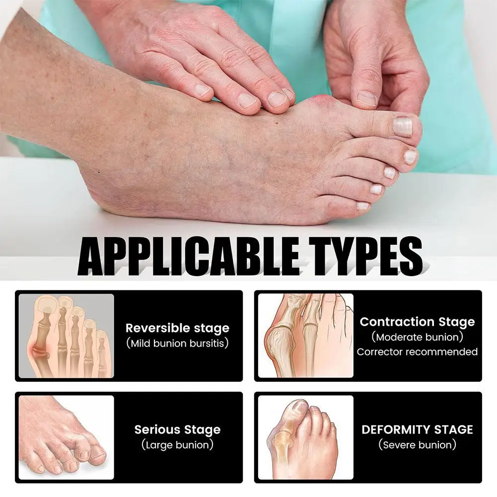 Orthopedic Bunion Corrector Health Sock-Anti-Bunions Toe Pain Relief Foot Care Tool for Outdoor Sports