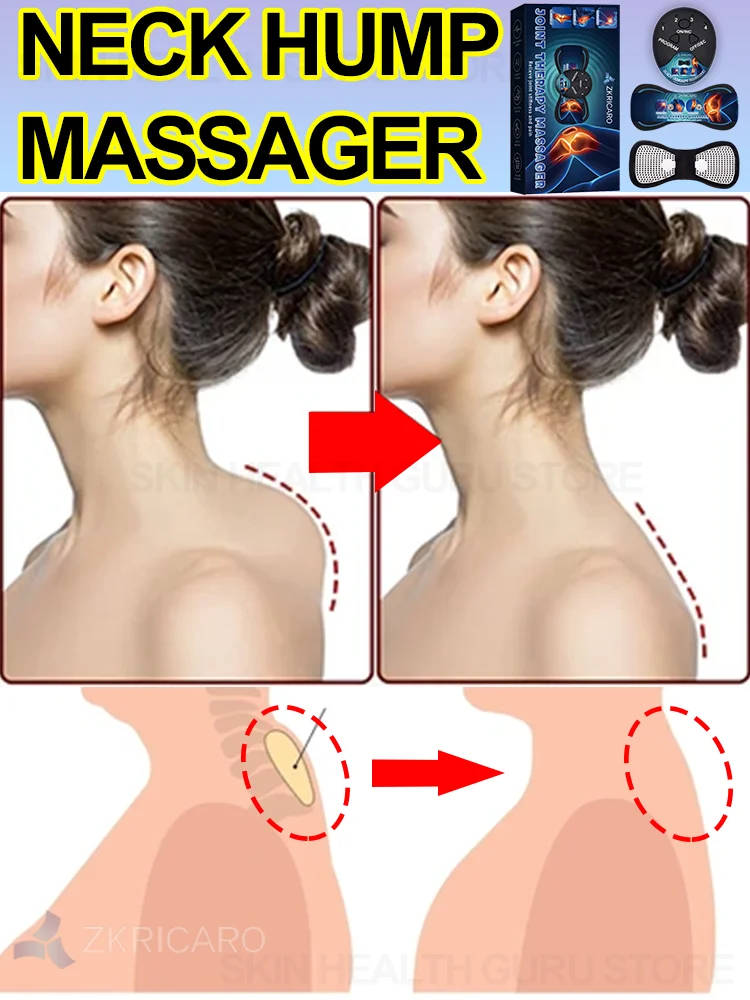Dowager's Hump Eliminate Cervical Massage for cervical massage