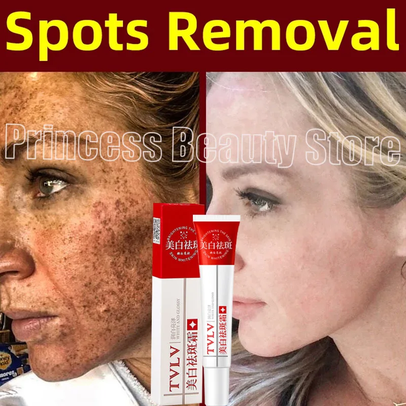 Whitening Freckle Cream Melasma Dark Spots Pigmentation Removal Products Fade Stain Melanin Repair Brighten Korean Skin Care