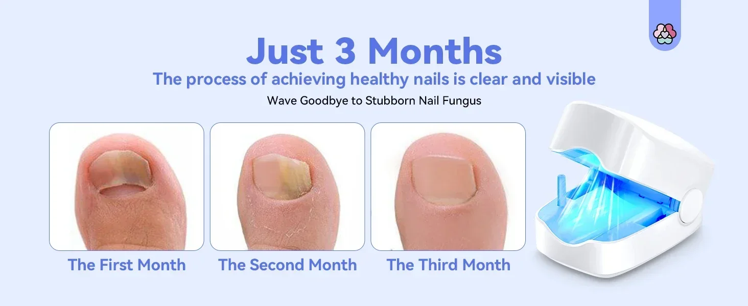 personal-health-care-only-3-months-to-get-nail-as-clar-as-new-when-use-device-each-day-picturepicture