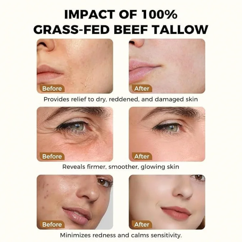 Luxurious Honey-Infused Beef Tallow Moisturizer - Deep Hydration & Redness Repair