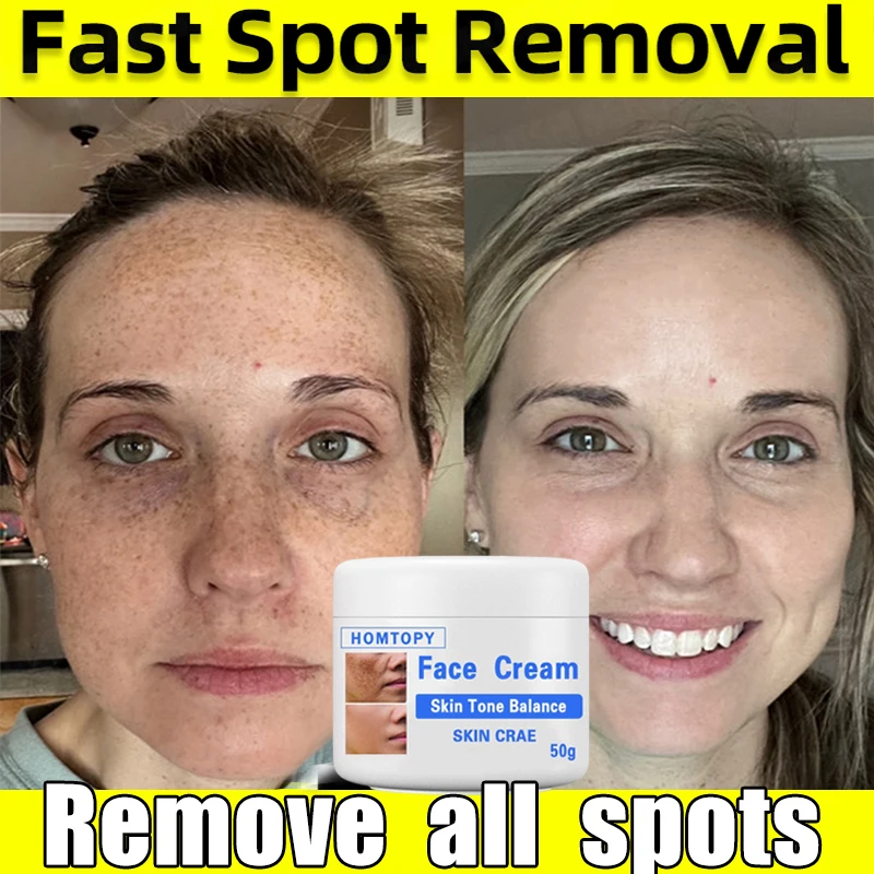 

Whitening Freckle Cream Remover Melasma Cream Remove Dark Spots Lightening Melanin Bright Skin Tone Lift Firming Face Skin Care