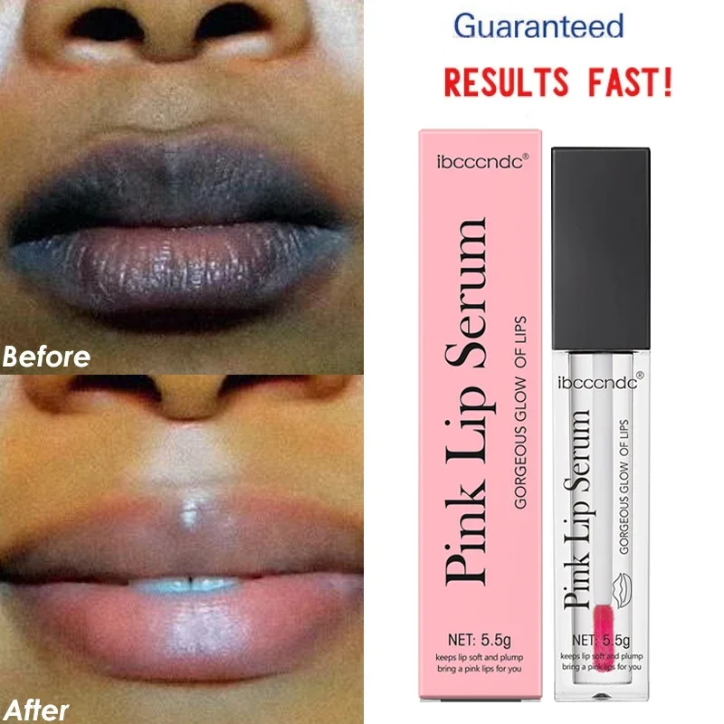 Lips Pink Fresh Whitening Serum Dark Lip Treatment Repair Sexy Pink Lip Essence Moisturizing Bleaching Dilute Melanin Lip Care