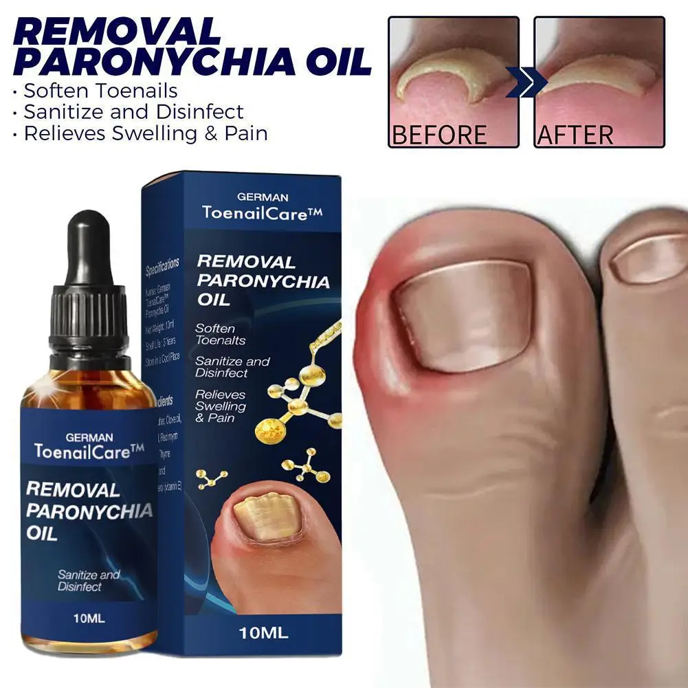 

10ml Nail Fungal Treatment Feet Care Essence Anti Infection Toe Removal Fungus Foot Paronychia Onychomycosis Solution Nail