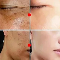 Crème blanchissante puissante anti-taches, éclaircissante pour la peau, élimine rapidement la Pigmentation de la mélanine, les taches foncées, soins coréens pour la peau du visage 3