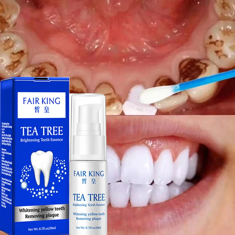

10pcs 20ml Teeth Whitening Serum Effective Dental Oral Hygiene Liquid Remove Stains Plaque Teeth Cleaning Essence Dental Care
