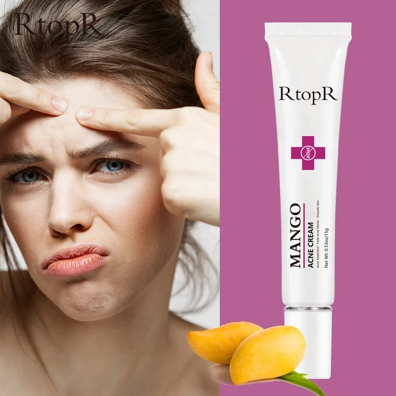 

Mango Repair Acne Cream Anti Acne Spots Acne Treatment Scar Blackhead Cream Shrink Pores Whitening Moisturizing Face 15g