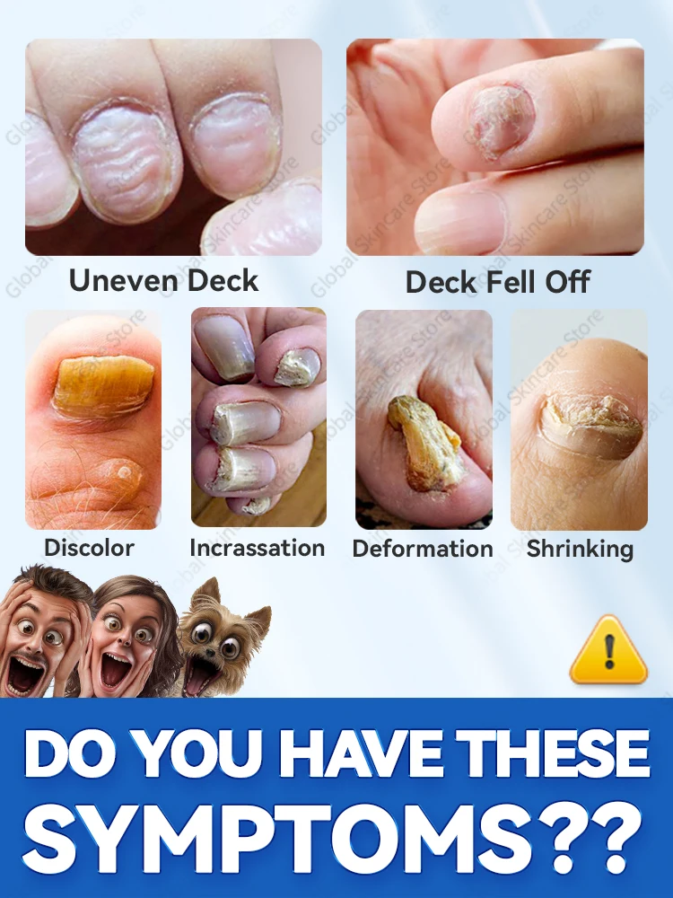 Foot Nail troubles Solved completely foot care tool foot pedicure tool ingrown toenail correction tool nail repair nail cuticle softener toenail fungus patch