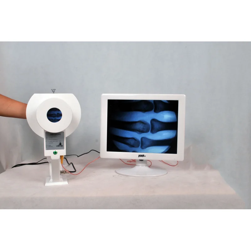 China Factory Good Quality Digital Xray Machine Digital Mobile X-Ray System