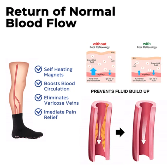 Turmalin Karcsúszó Egészség Zokni Önellátó Zsírcsökkentő Termoterápiás Serkenti A Vér Keringését - Image 5