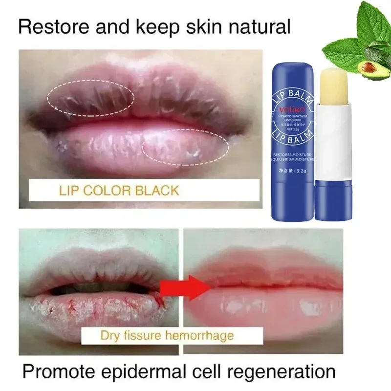 Whitening Remove Dark Lip Balm Moisturizing Cream Hyaluronic Acid Exfoliating Dead Skin Lightening Pigment Care Beauty Health hyaluronic acid remove dark lip balm whitening moisturizing cream exfoliating dead skin lightening pigment care beauty health