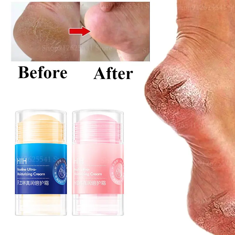 

2Pcs Anti-Dry Cracked Foot Hand Cream Vaseline Moisturizing Cream Smooth Wrinkle Multi Balm Stick Removal Dead Skin Feet Care