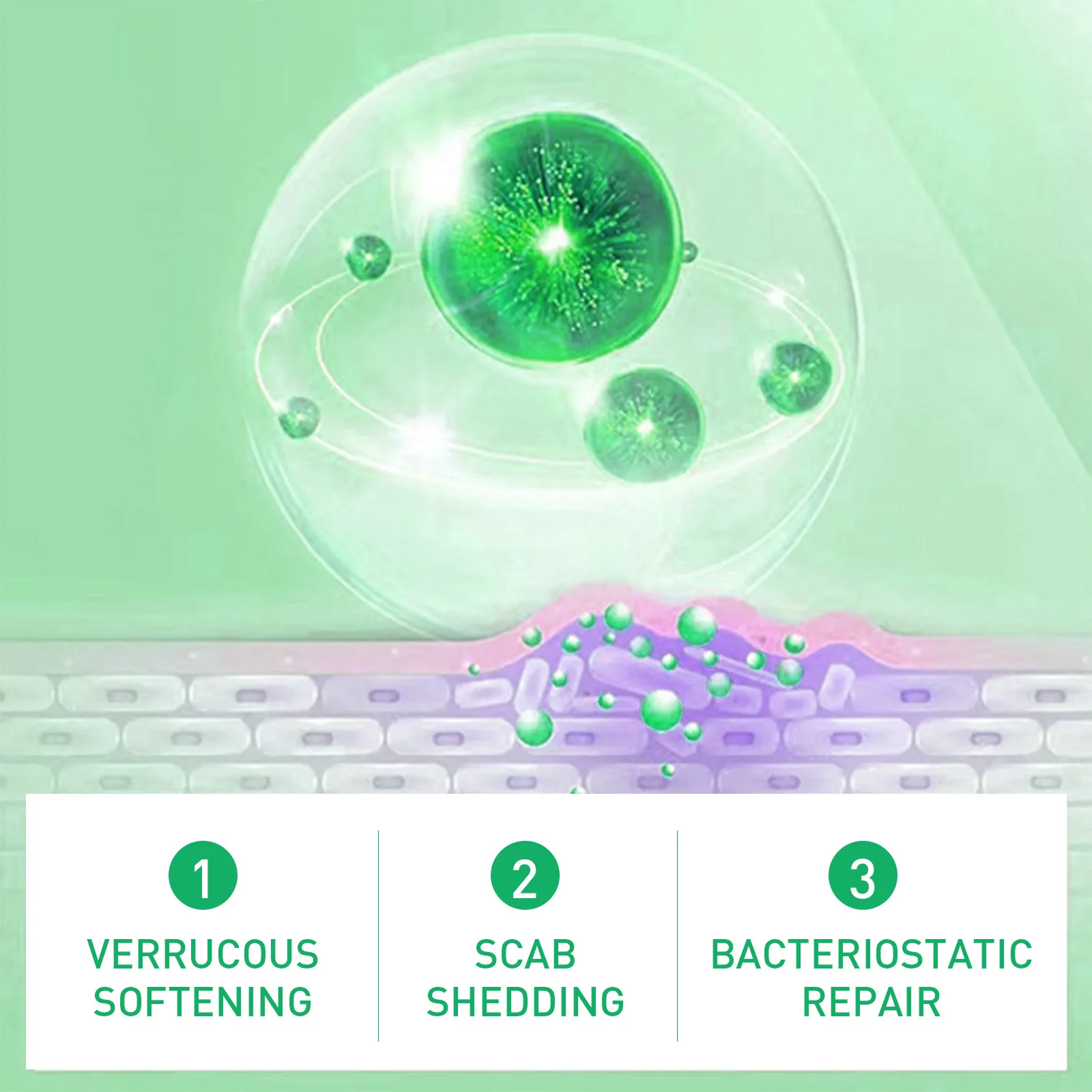 Manicure Pedicure Tools Personal Health Care Pain Analgesic Cream Foot Corn Removal Cream Chicken Eye Skin Infection Treatment Chicken Eye Solution Foot Dead Skin Scab Removal Tool Health발톱무좀