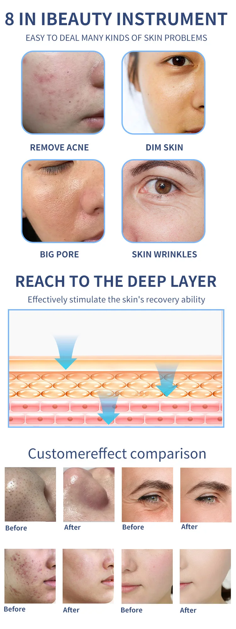 8-in-1 Professional Facial Machine for Deep Cleansing, Skin Rejuvenation & Acne Treatment 10 The <strong data-start="896" data-end="935">8-in-1 Multifunction Facial Machine</strong> is engineered for professional estheticians, dermatology clinics, and advanced skincare centers. This all-in-one platform integrates <strong data-start="1069" data-end="1111">eight essential treatment technologies</strong>, enabling comprehensive facial care—from deep pore cleansing to anti-aging rejuvenation. 8-in-1 Professional Facial Machine for Deep Cleansing, Skin Rejuvenation & Acne Treatment
