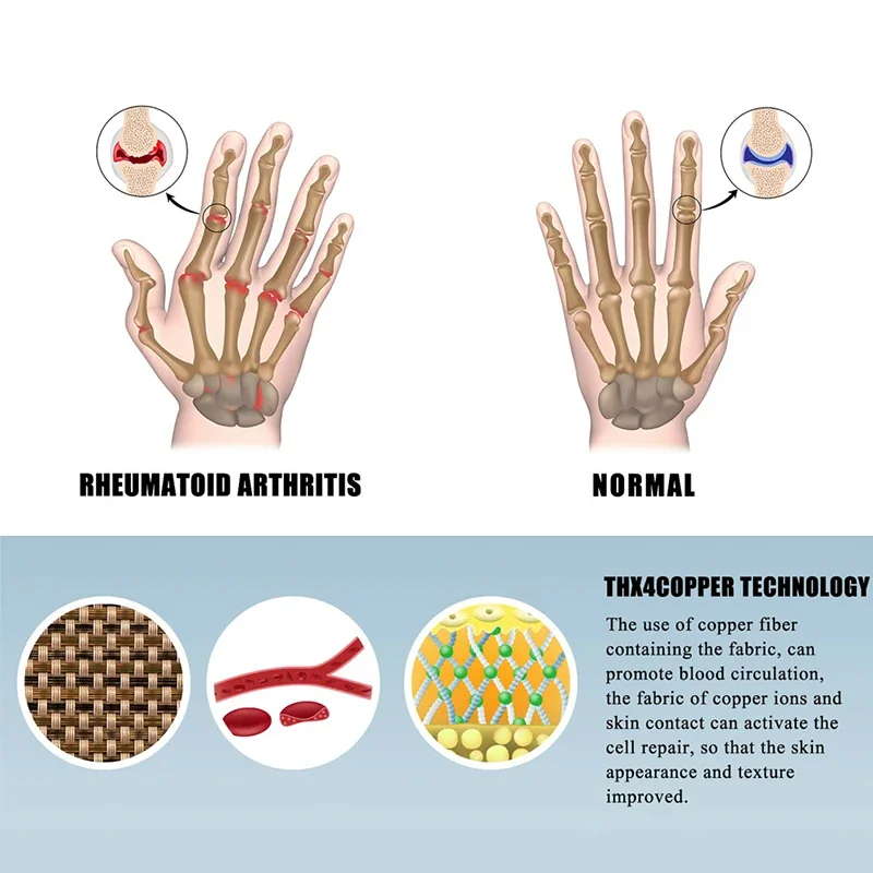 Winter Gloves 1 Pairs Arthritis Touch Screen Gloves Anti Arthritis Therapy Compression and Ache Pain Joint Relief