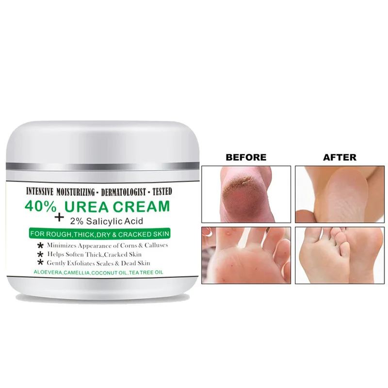 

Urea 40% Cream for Dry Cracked Feet Heels Hands Body Repairing Treatment Deeply Moisturizing Callus Dead Skin Remove Foot Care