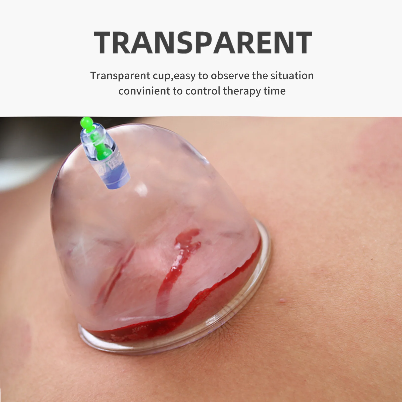 9.5CM Big Size Plastic Vacuum Cupping Cups Suction Cups Jar Massage Vacuum Cupping Massager Jars Suction Therapy Cupping Cans 2