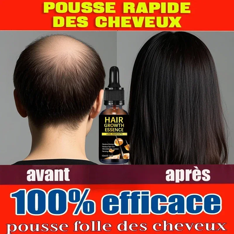 Effective Hair Growth Oil Loss Repair Genetic Hair Loss Postpartum Seborrheic