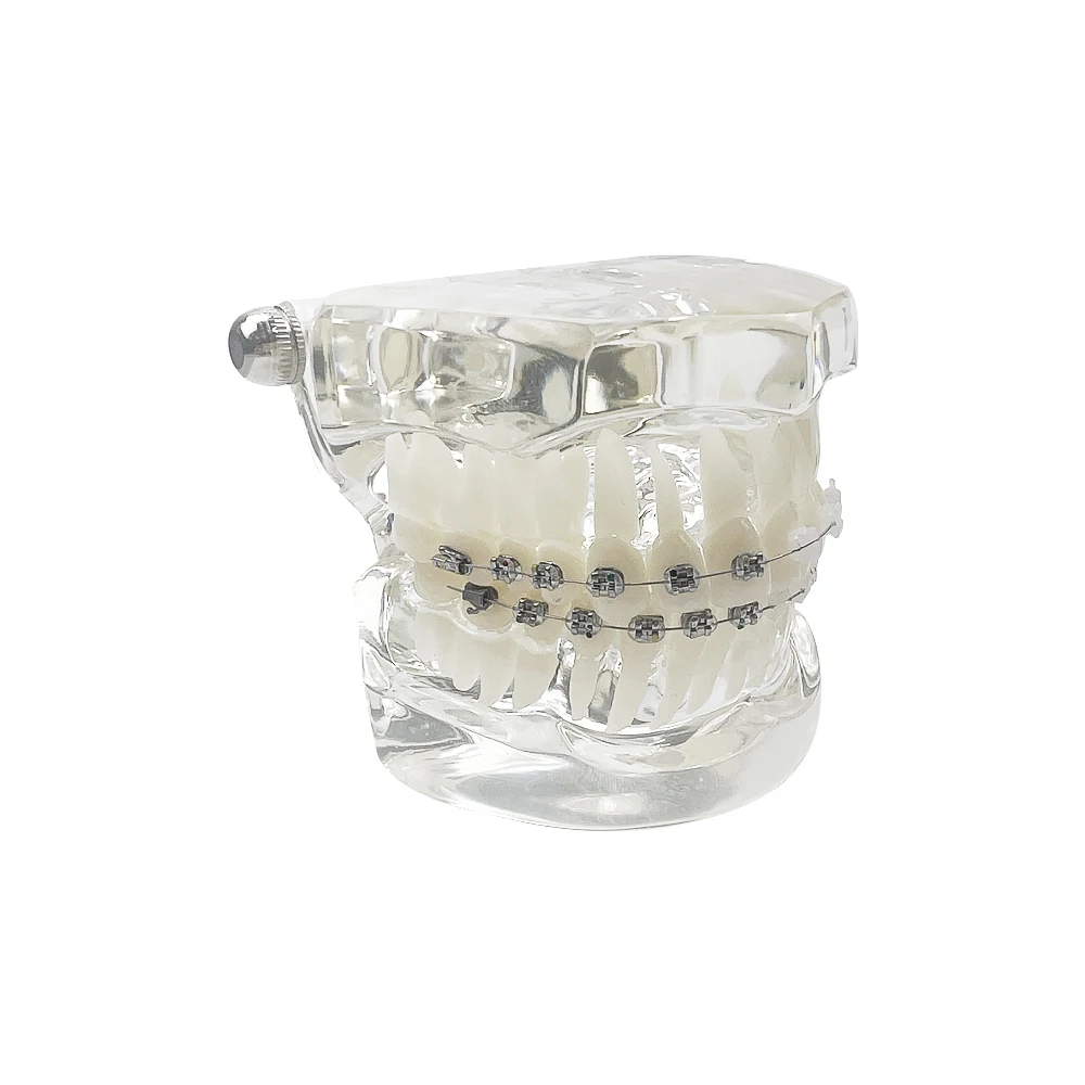 치과 교정 모형 타이포돈트 반금속 반세라믹 교정 치아 모형 학습 교육 환자 교육용