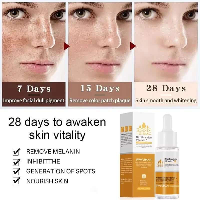 Nicotinamide Whitening Freckles Serum Face Dark Spot Remover Vitamin C Lightening Melanin Blemish Moisturizer Brighten Skin Care 5