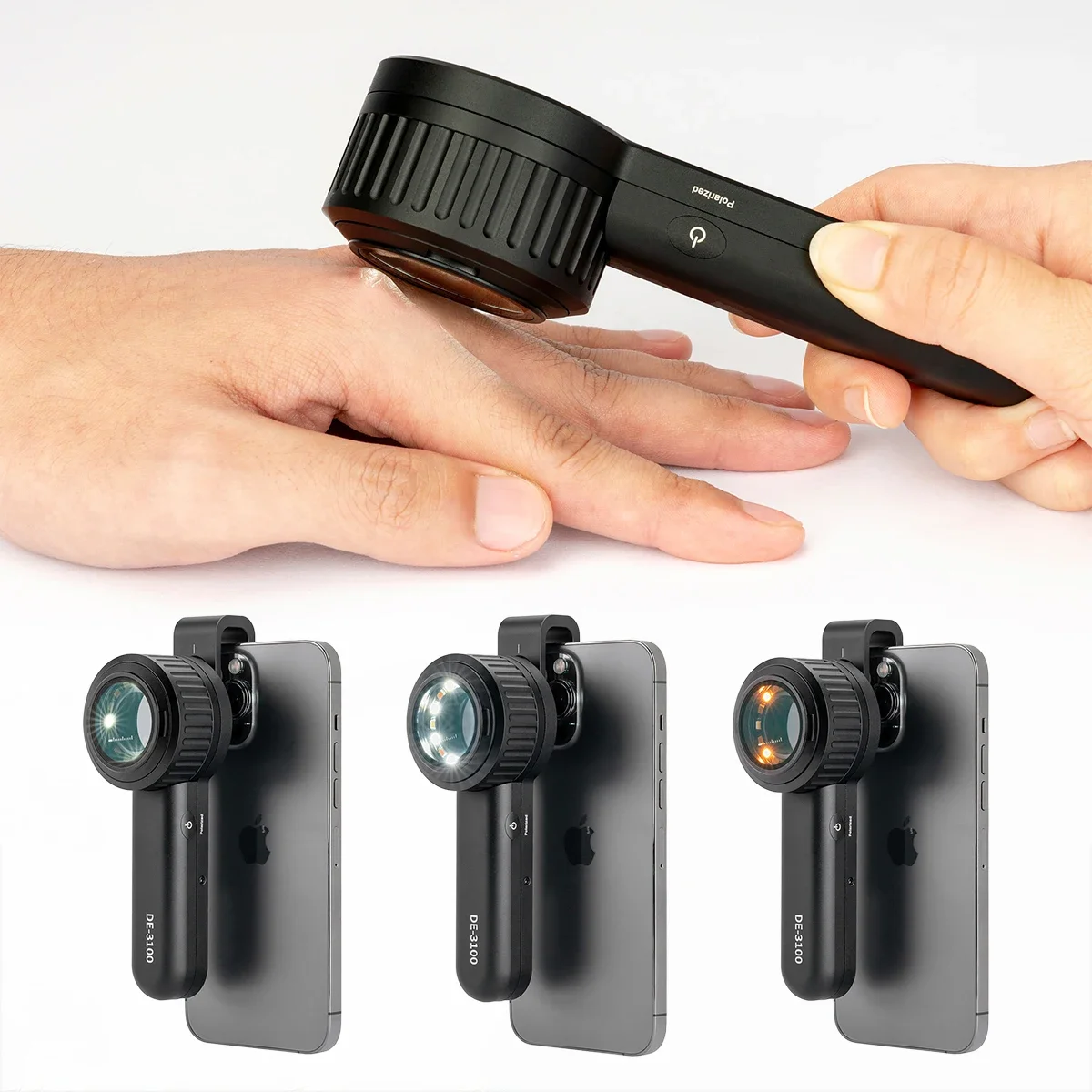 DE-3100 Handyscope Smartphone Mobile Dermatoscope Dermoscope Trichoscope