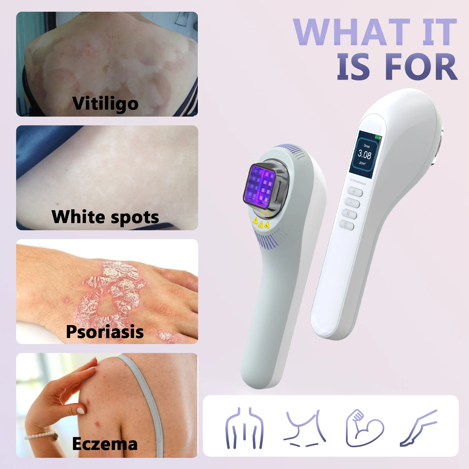 KTS Vitiligo Lamp for Home Use 308nm UVB Lamp for Vitiligo Ultraviolet Phototherapy Device Psoriasis Spots Eczema Skin Disease