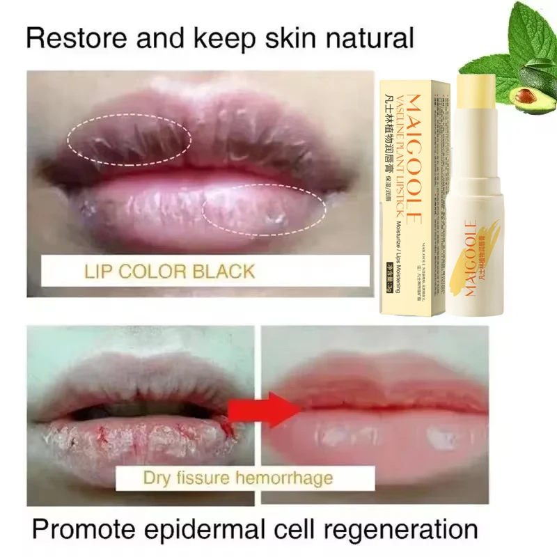 Fast Lightening Pink Mouth Lips Serum Bleaching Permanent Pinkish Moisturizing Lighten Dark Lip Balm Gloss Lipstick Lip Mask 5