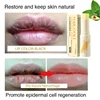 Fast Lightening Pink Mouth Lips Serum Bleaching Permanent Pinkish Moisturizing Lighten Dark Lip Balm Gloss Lipstick Lip Mask 5