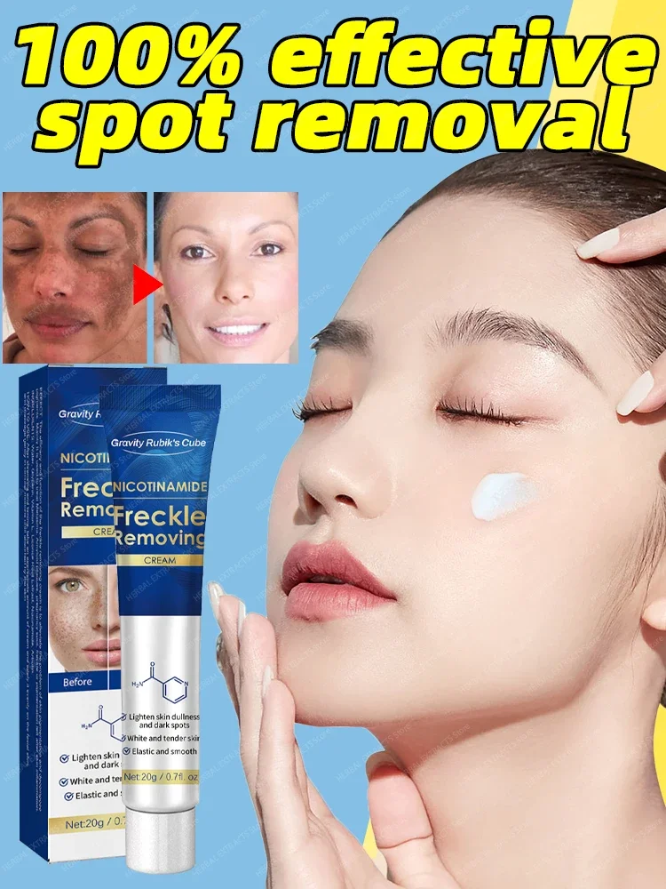 

Dark Spot Remover For Face Cream Black Age Sun Spots Freckle Melasma