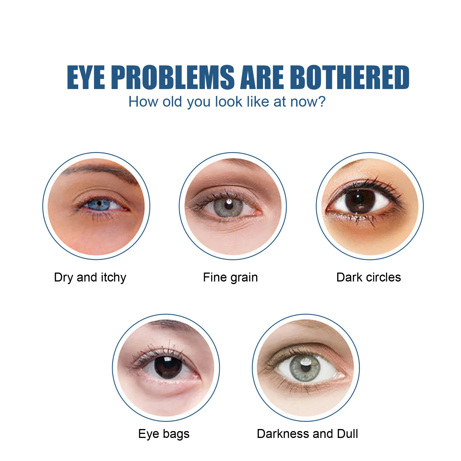 Details 141+ bags under eyes liver esthdonghoadian