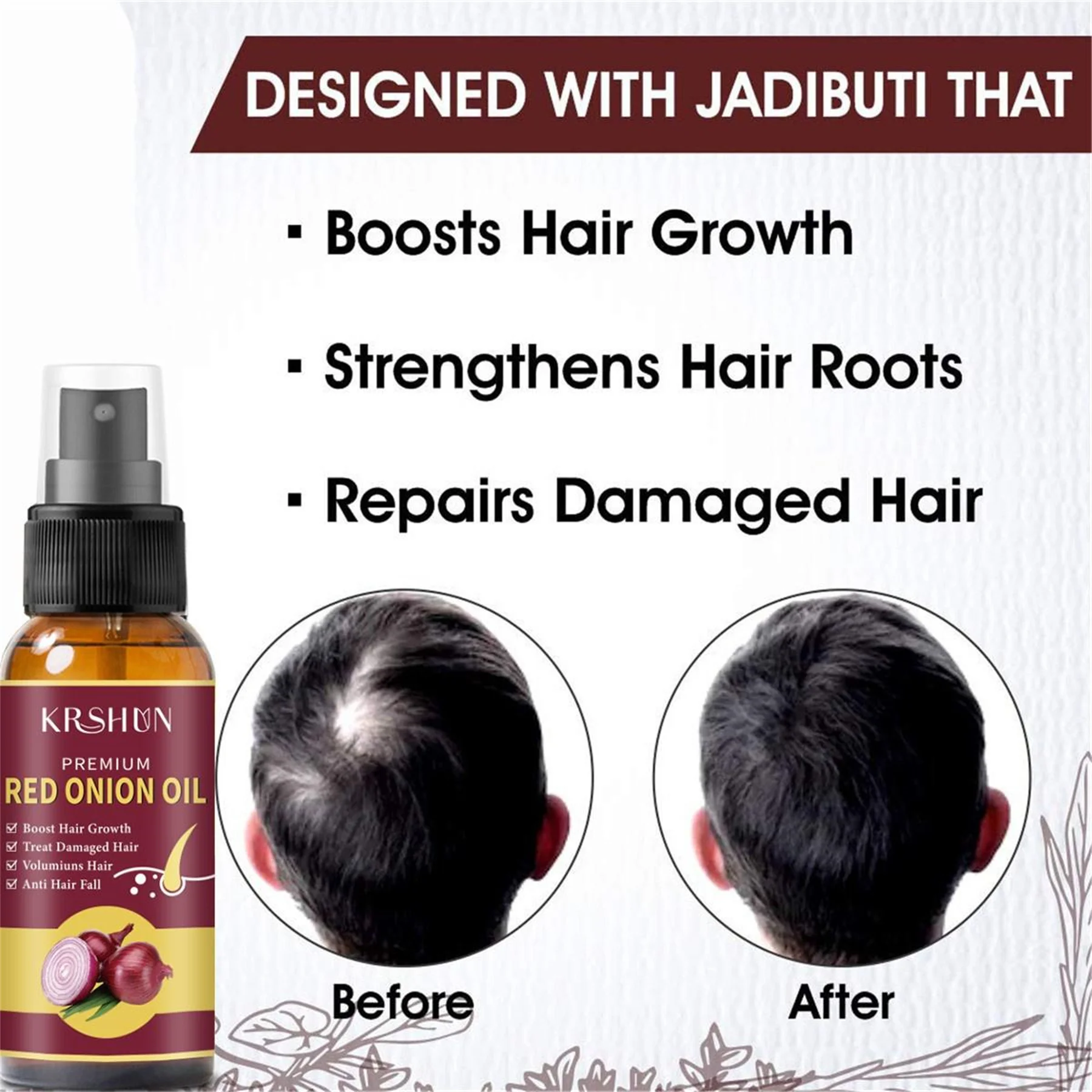 Onion Black Seed Hair Treatment Oil Spray for Natural Hair Care and Growth Prevent Loss Biotin Fast Growth