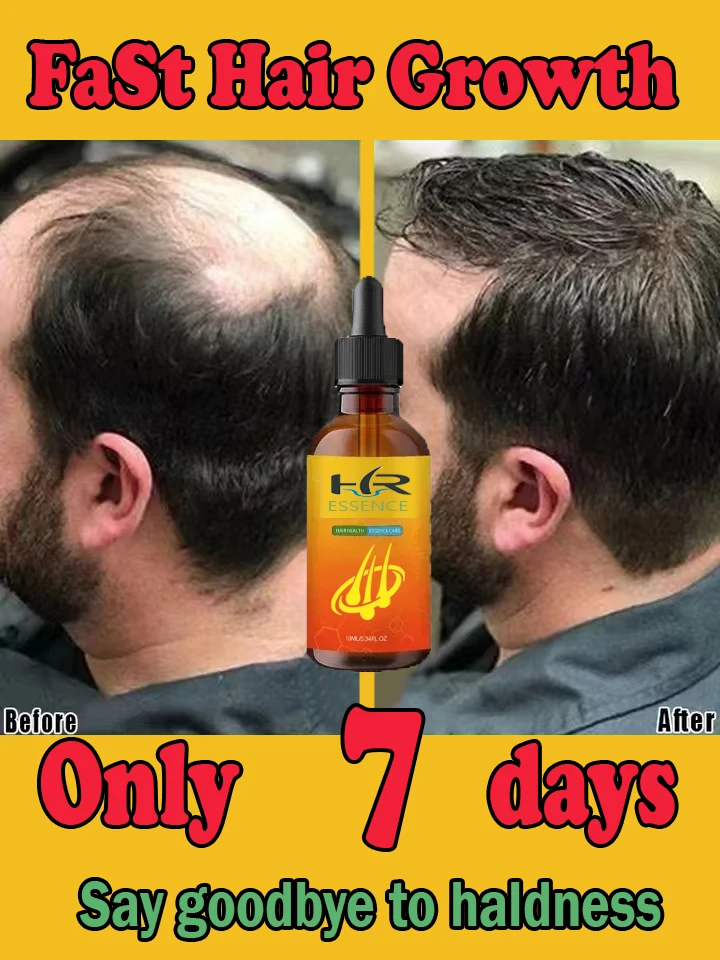 Essential oils that promote long hair can grow anywhere and help prevent hair loss according to latest research results
