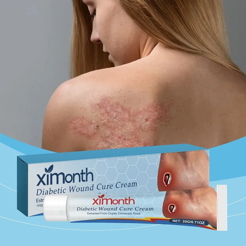 Bedsores Treatment Cream Removal Rot Myogenic Pressure Sores Ulcer Festering Wound Healing Anti Infection Necrotic Skin Ointment